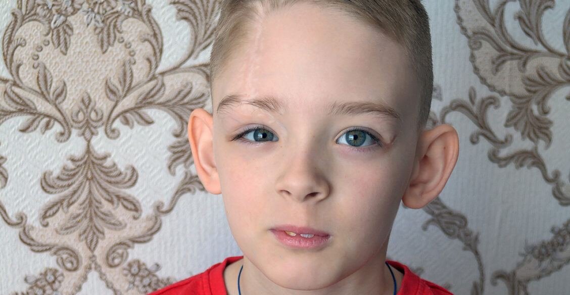 «Что у тебя с головой?» — спрашивают сверстники. Илья не помнит