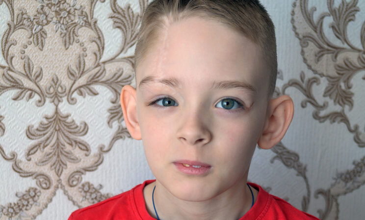 «Что у тебя с головой?» — спрашивают сверстники. Илья не помнит