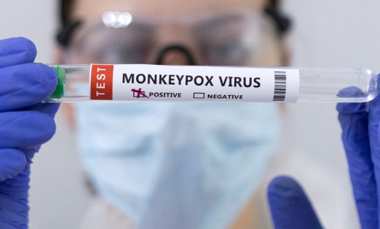 В мире распространяется обезьянья оспа. Чем она опасна?