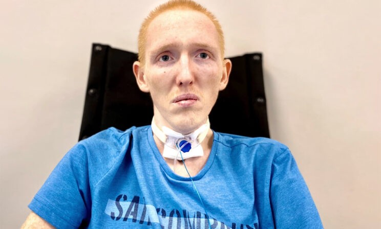 «К нему нельзя». За месяц в больнице Федор потерял 40 килограммов