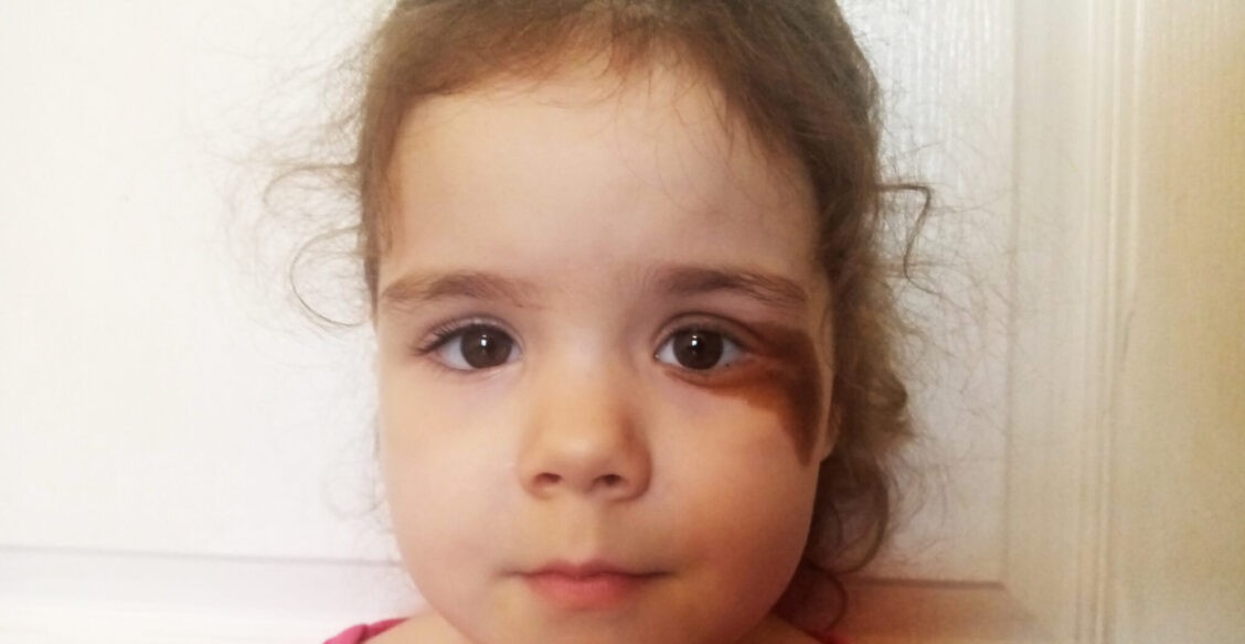 Никто не понимает, как лечить Катю. Ее болезнь прогрессирует