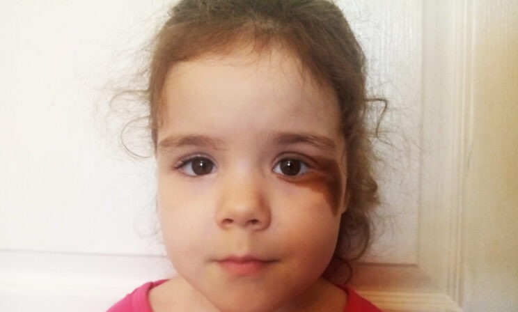 Никто не понимает, как лечить Катю. Ее болезнь прогрессирует