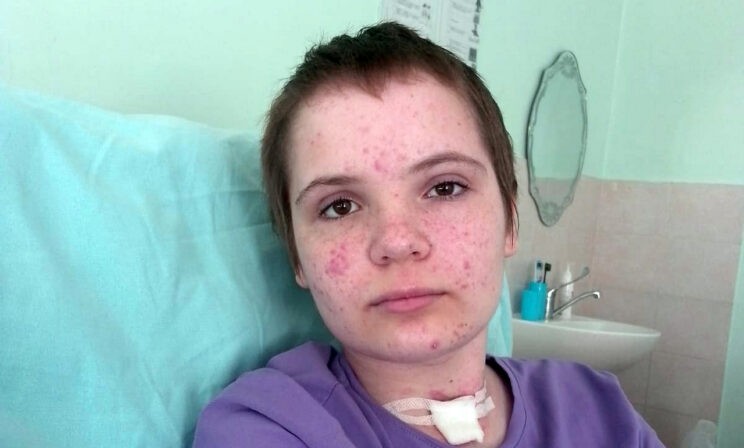 Водитель сбил Ксюшу на пешеходном переходе. Теперь она не может ходить