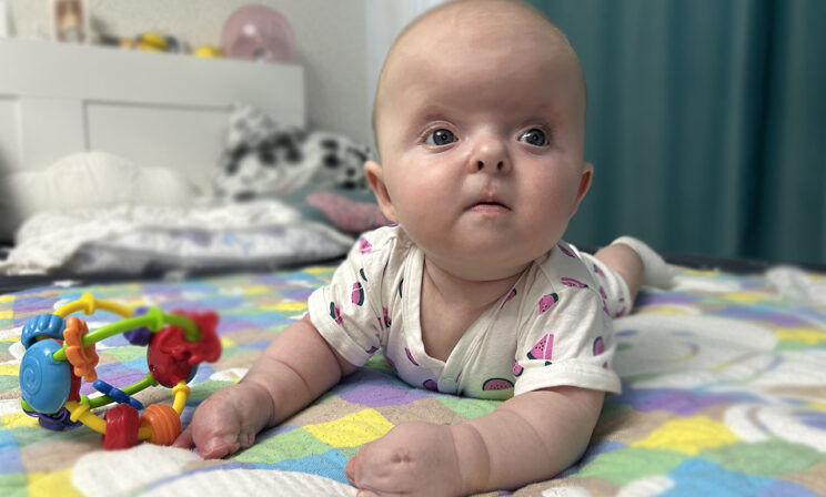 У 5-месячной Саши редкий синдром Апера. Ей нужна операция, чтобы исправить деформацию черепа