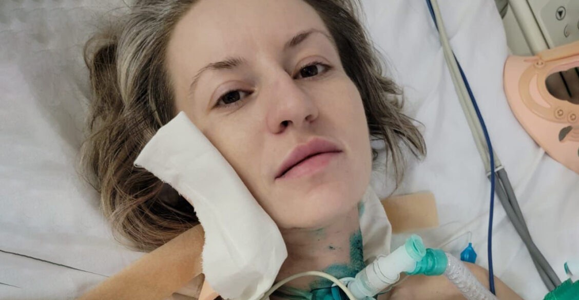 В машину Марины врезалась фура. Девушка провела в реанимации три месяца