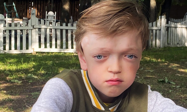 У Леши прогрессирует искривление позвоночника. Врачи не знают, что с ним