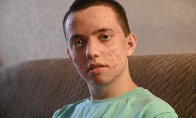 Марату сделали операцию на мозге и удалили 90% опухоли