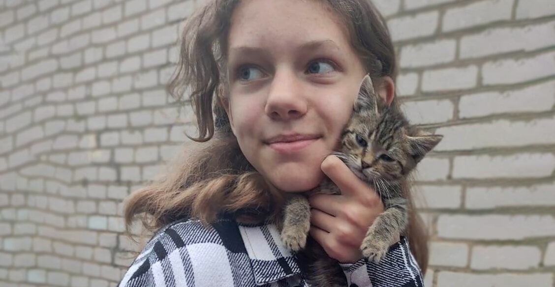 Из-за резкого роста позвоночник Ани искривился, а одна нога стала короче другой