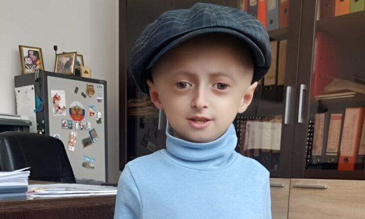 У Астемира синдром преждевременного старения