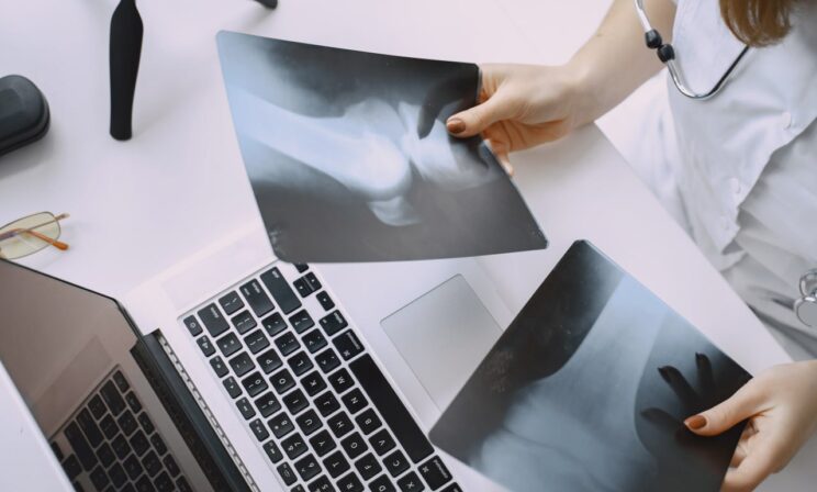 Ученые МГУ создали инновационный гибкий материал для рентгена