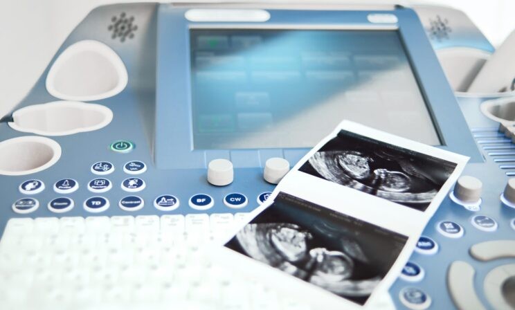 Минздрав: в России почти на 50% выросла доступность ЭКО