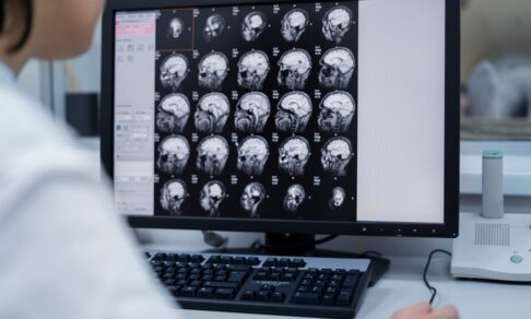 Исследование: у всех оптимистов мозг работает схожим образом при размышлениях о будущем