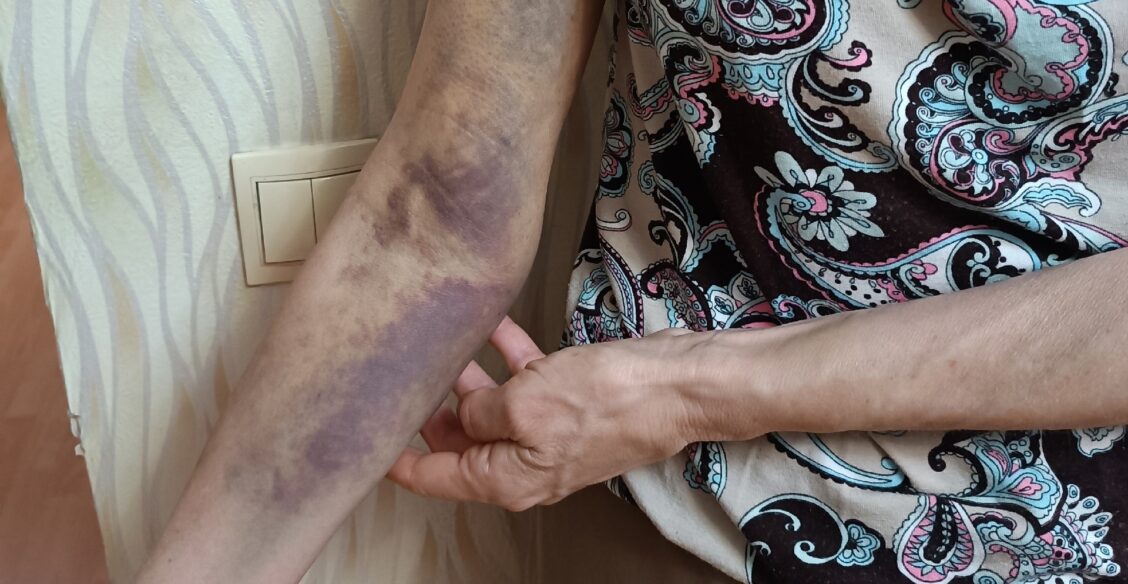 В Рязани полицейские приняли учителя на прогулке за закладчицу и жестко задержали ее