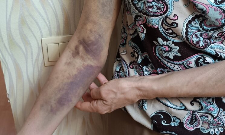 В Рязани полицейские приняли учителя на прогулке за закладчицу и жестко задержали ее