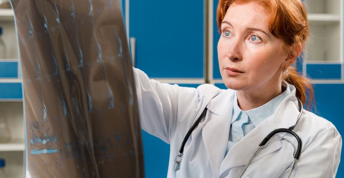 Исследование: ИИ стал выявлять признаки онкологии на уровне специалистов