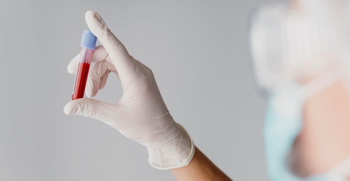 Российские ученые упростили метод мониторинга атеросклероза