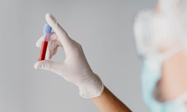 Российские ученые упростили метод мониторинга атеросклероза