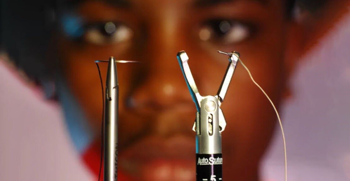 14-летний подросток разработал собственную хирургическую технику