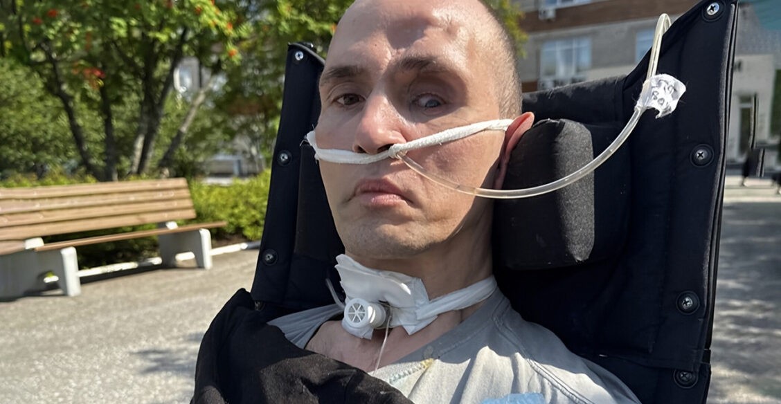 При взрыве газа на буровой Руслан получил тяжелую травму