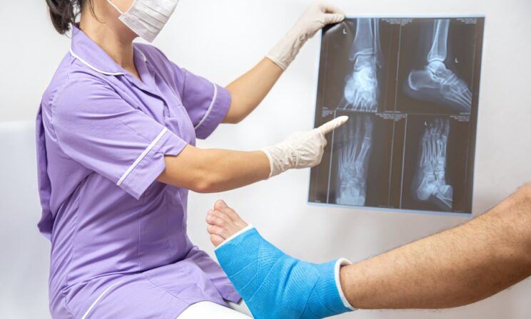 Китайские ученые разработали «костный клей», заживляющий переломы за минуты