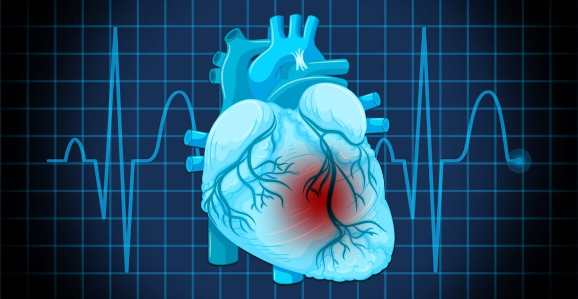 В Москве врачи спасли пациента с пульсом 300 ударов в минуту