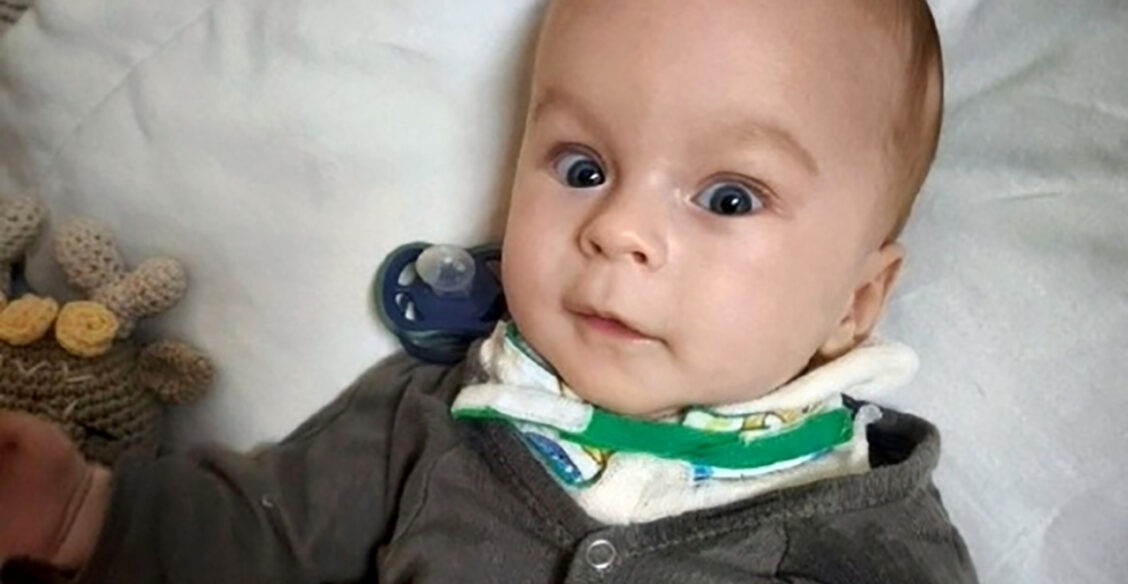 Матвей научился улыбаться, ему пять месяцев. Впереди у него четыре операции