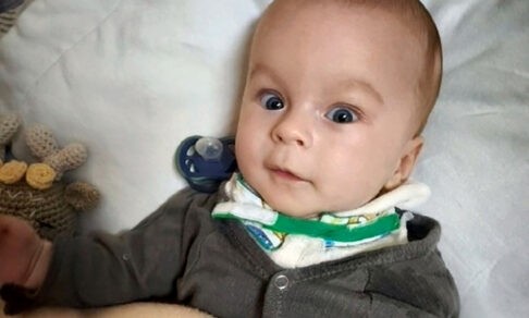 Матвей научился улыбаться, ему пять месяцев. Впереди у него четыре операции