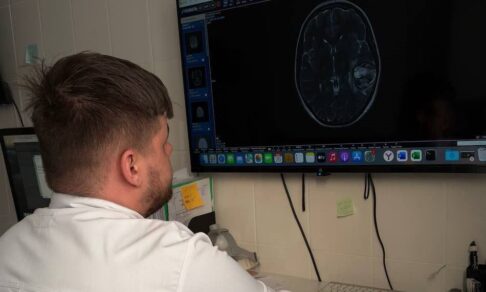 Саратовские хирурги спасли девушку от потери речи из-за опухоли