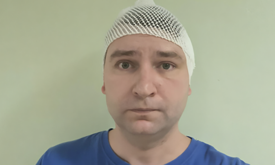 У Александра новообразование в правой височной области